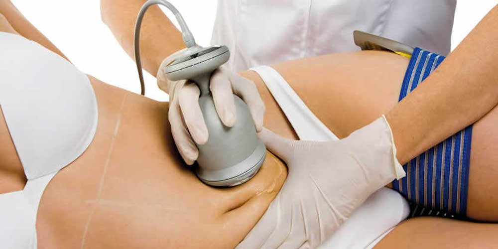 What Is Ultrasonic Cavitation