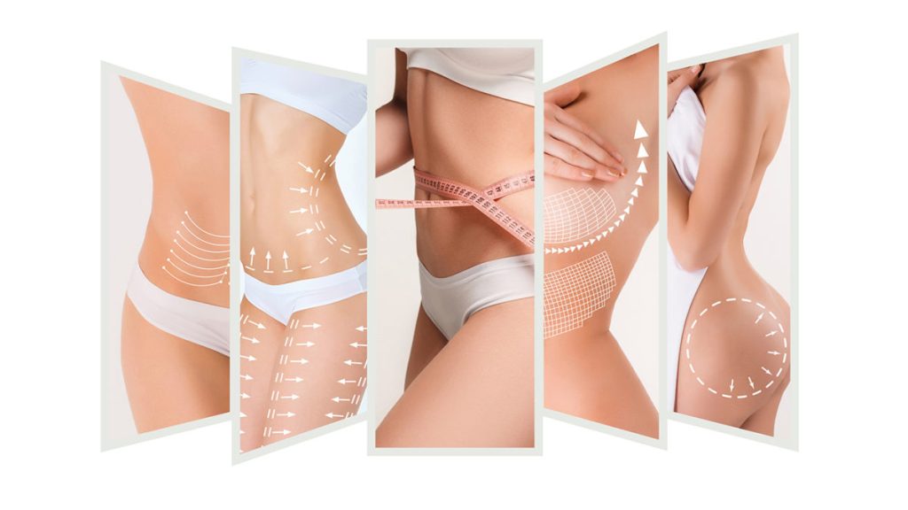 Liposuction Newcastle