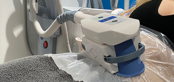 Does Fat Freezing Really Work? Your Guide to Cryolipolysis