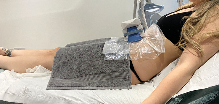 The Advantages of Fat Freezing