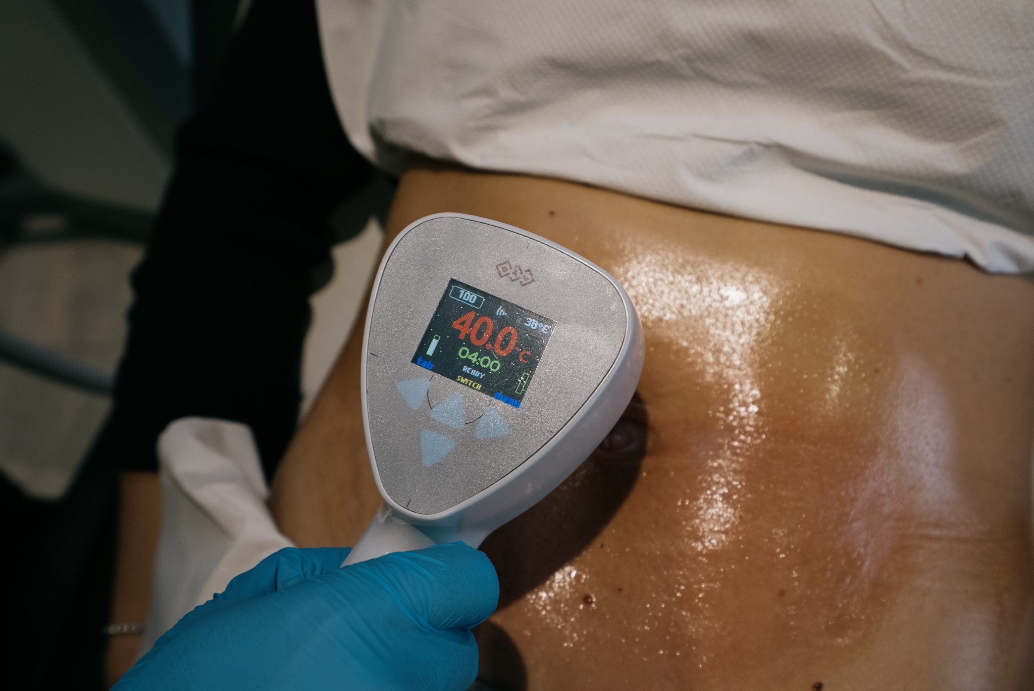 BTL Exilis® Ultra Body