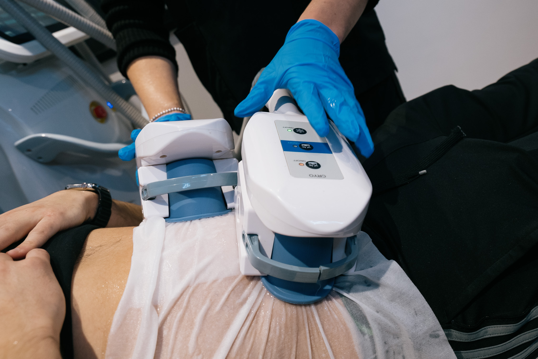 MED: 360 Cryolipolysis